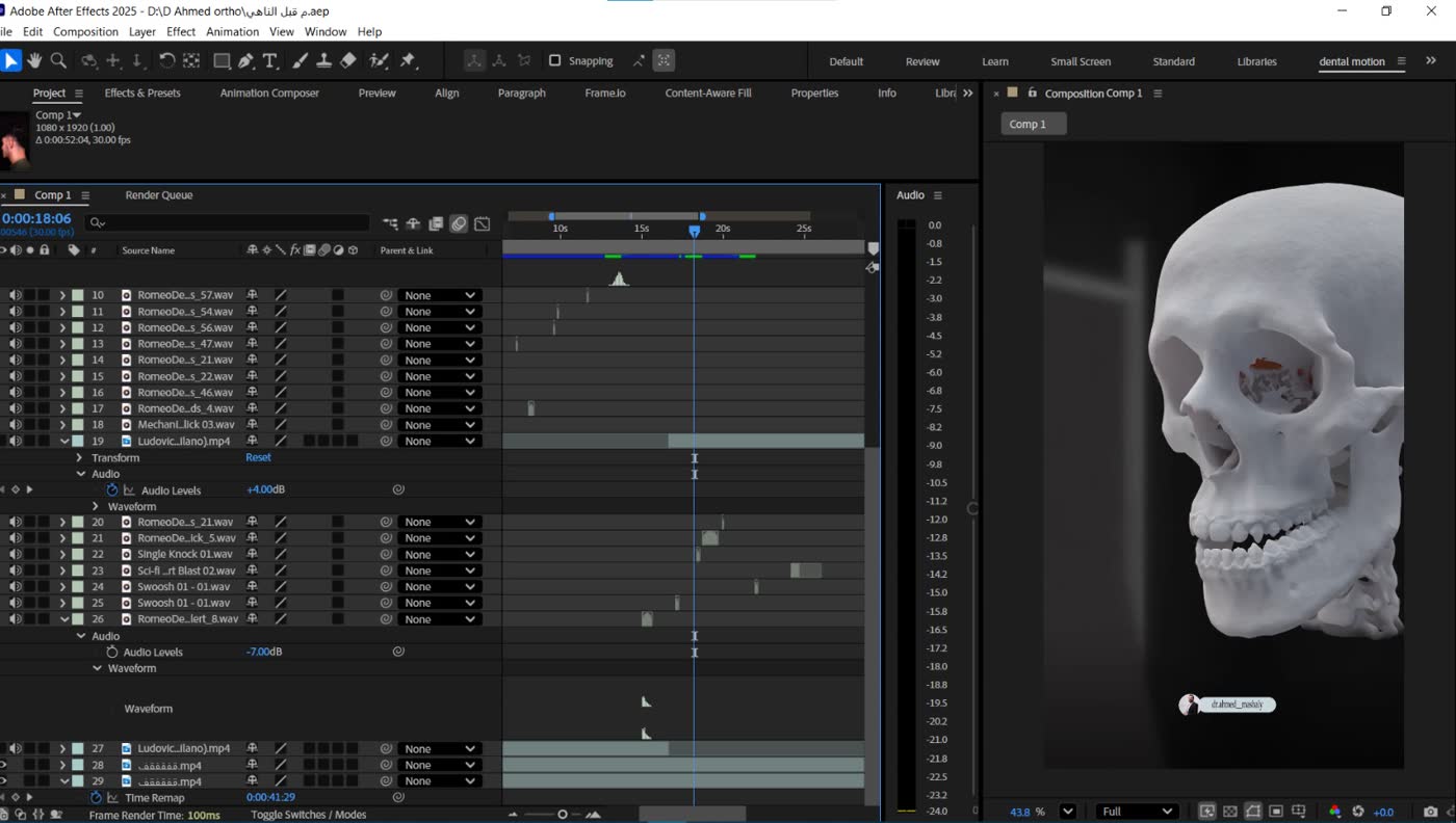 مشروع دينتل موشن داخل After Effects